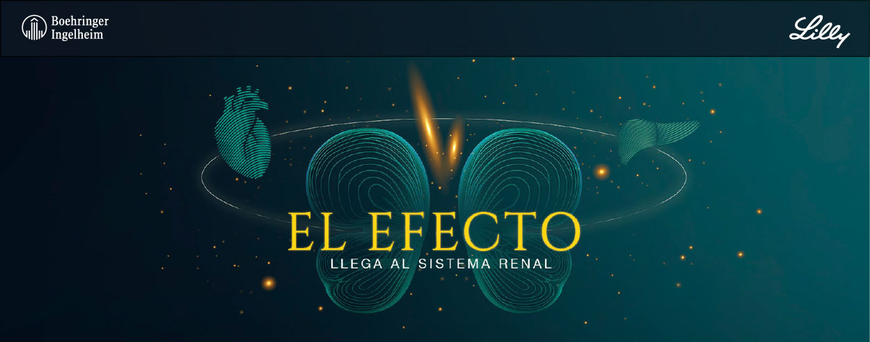 El Efecto